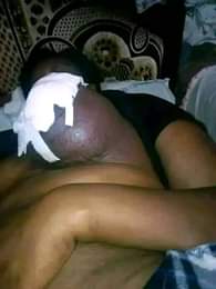 A picture of A PAINFUL CRY for EKWENUYA CYNTHIA Donation Request From A