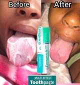 A picture of SULUHISHO LA AFYA YA KINYWA MENO HAKUNA KUNG OA JINO