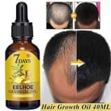 A picture of HAIR GROWTH