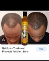 A picture of Natural hair Grow oil