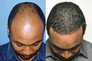 A picture of Hair Essential Oils
