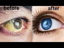 A picture of WHITE EYES