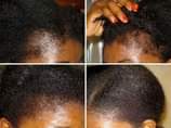 A picture of Hair Growth oil