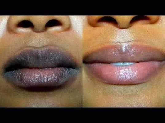 A picture of 5 days Pink lips balm