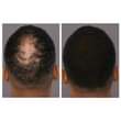 A picture of Hair growth pomade