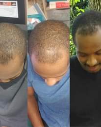 A picture of Original hair grow oil