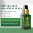 A picture of All in One Skin care Set for Acne Treatment Scar