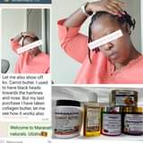 A picture of Zero Pimples Acne Warts Rash Dark spots Eczema