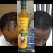 A picture of Hair growth oil