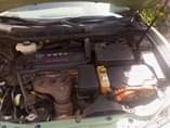 A picture of Clean body 2007 model facelifted to 2012 model No fillers