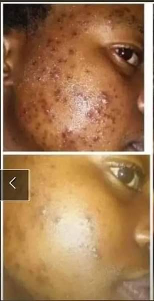 A picture of Miiratiara Skin care products