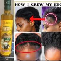 A picture of Original hair grow oil
