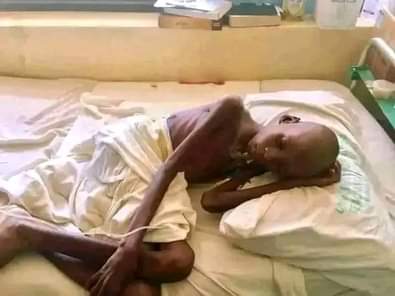 A picture of HELP THIS INNOCENT SOUL only one good Samaritan 1 2millionsuganda