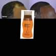 A picture of Hair Growth Oil And Shampoo