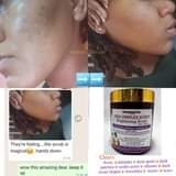 A picture of There are so many Benefits of Collagen Improves skin elasticity